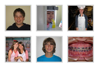 Dr. Chang Orthodontics' Smile Gallery